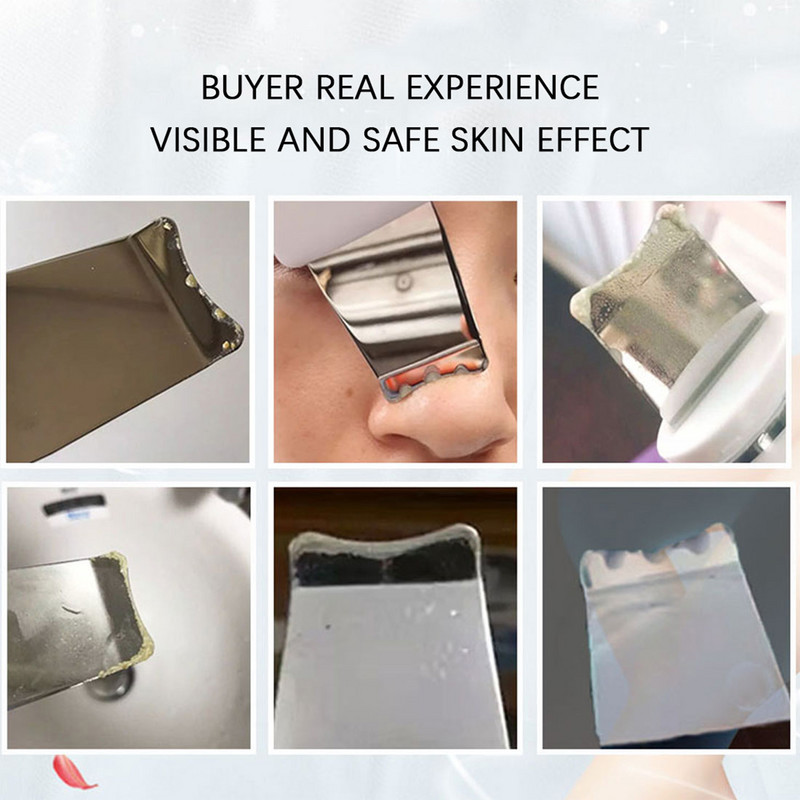 Ultrahangos bőrradír peeling mitesszer eltávolító mély arctisztító ultrahangos ionos ance pórustisztító arclapátos arctisztító