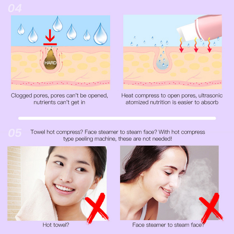 Ultrahangos bőrradír mély arctisztító gép peeling lapát arc pórustisztító arcbőrradír lifting gép