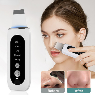 Ultrahangos bőrradír peeling mitesszer eltávolító mély arctisztító ultrahangos ionos ance pórustisztító arclapátos arctisztító