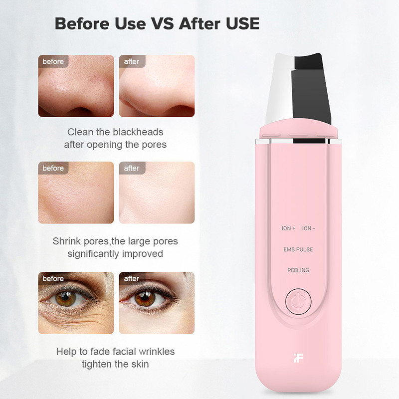Ultragarsinis joninis veido odos šveitiklis giluminis veido porų valymas pilingas kastuvas Odos priežiūros prietaisas masažuoklis grožio priemonė