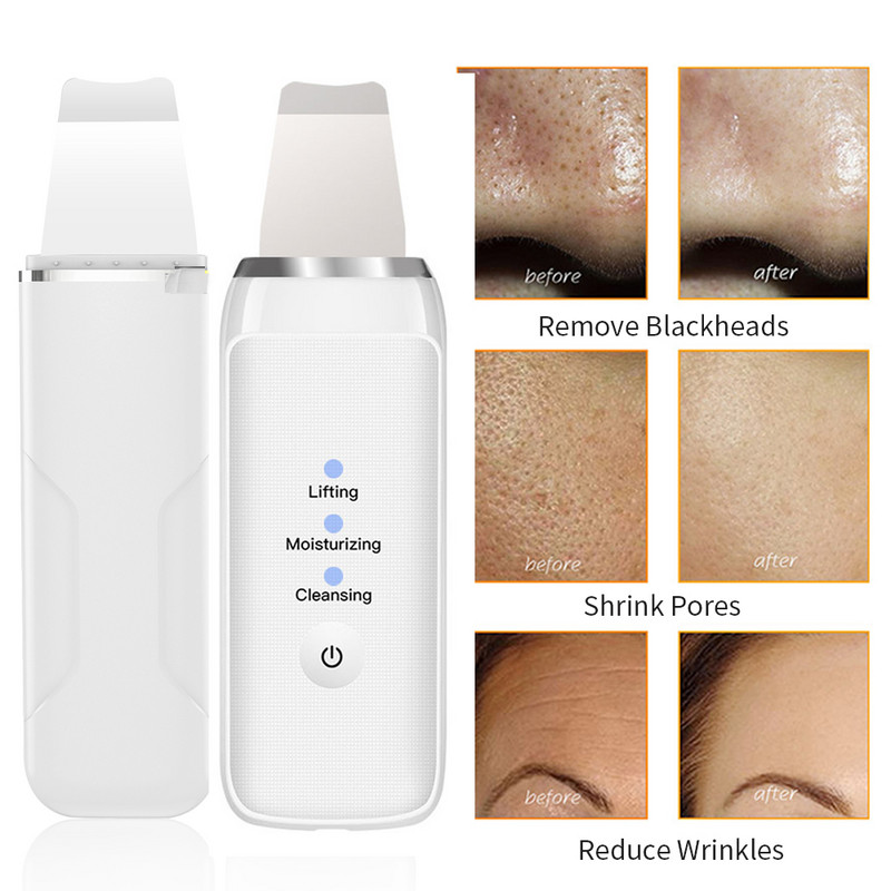 Face Lift gép Arcmasszírozó Kavitációs Peeling Arctisztító Bőrradír Deep Clean Peeling Lapátkaparó