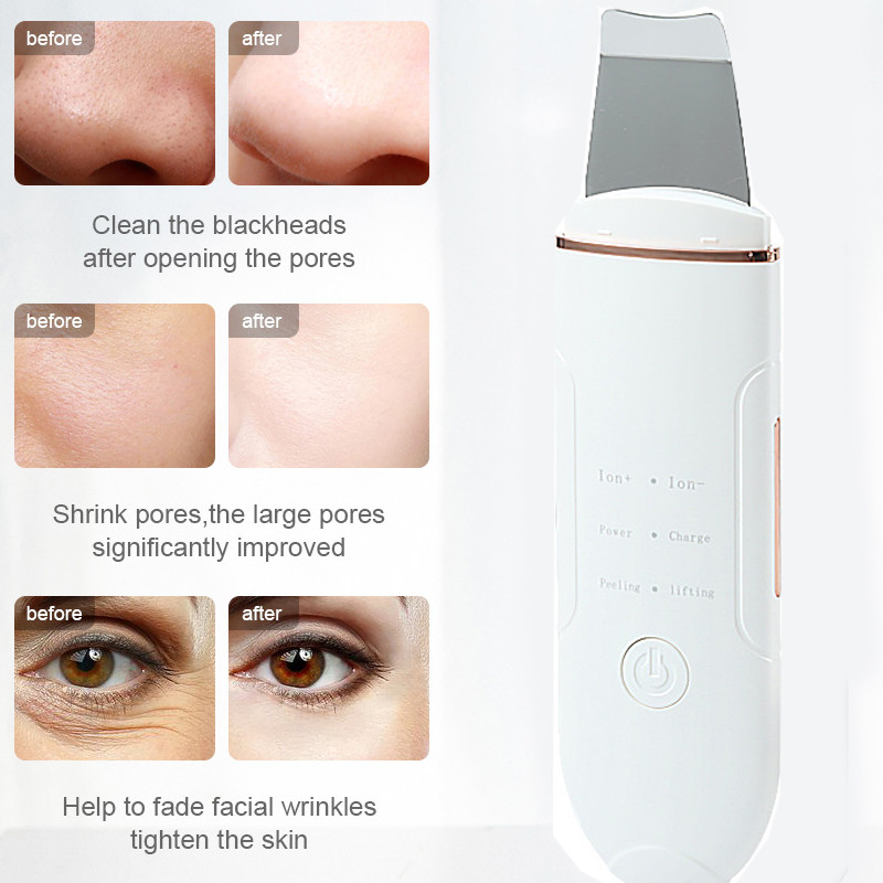 Ultrahangos bőrradír vibrációs mély arctisztító gép peeling lapát arc pórustisztító arcbőrradír lifting gép