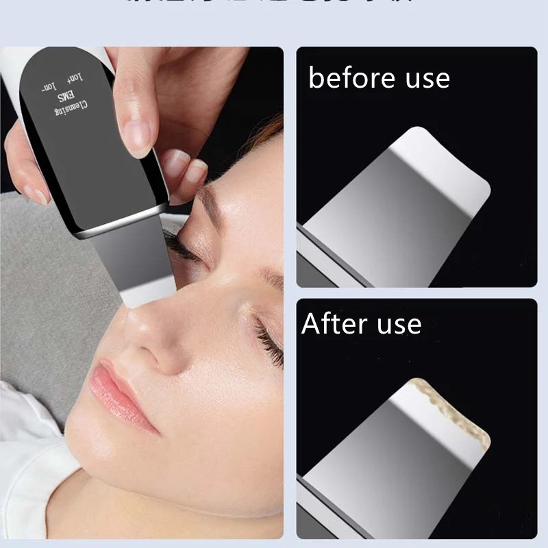 Arc peeling spatula pórustisztító ránctalanító gép ultrahangos bőrradír EMS Ion kutikula sötét foltos bőrápoló eszköz