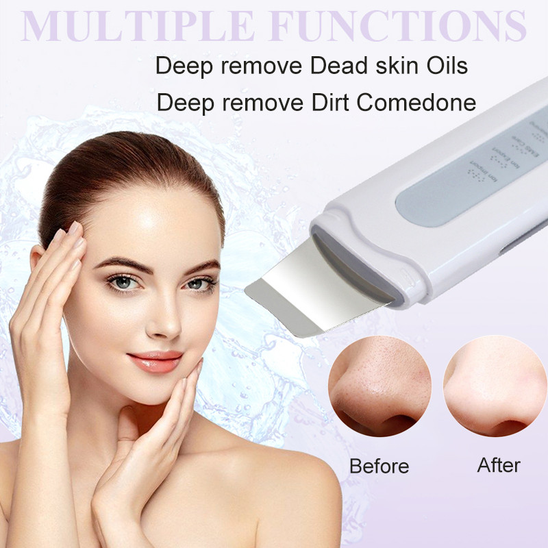 Ultrahangos bőrradír elektromos mélytisztító gép peeling lapát arc mitesszer pórustisztító bőrápoló készülék