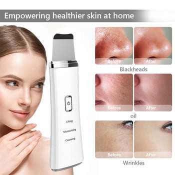 Υπερηχητικό Skin Scrubber Spatula Face Remover Blackhead Facial Shovel Clean Cavitation Peeling Cavitation Ion EMS Lift