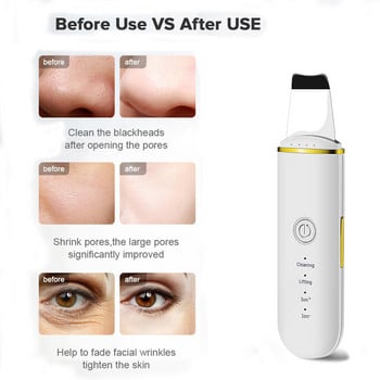 Beauty Ultrasonic Skin Scrubber Plug USB Facial Cleansing Remover Face Cleaner Μηχανή περιποίησης δέρματος Εργαλεία μασάζ ακμής