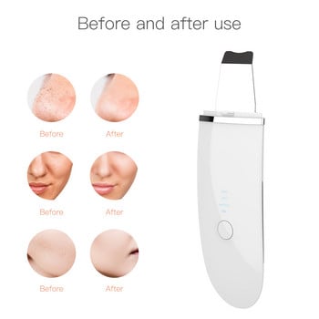 Ultrasonic Skin Scrubber Base Charge Acne Remover Deep Cleaning Machine Ion Face Lifting Facial Massager