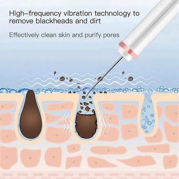 Υπερηχητικό Skin Scrubber Facial Spatula Shovel Ion Deep Face Cleaning Αφαίρεση πόρων Cleaner Face Lift Beauty Devices