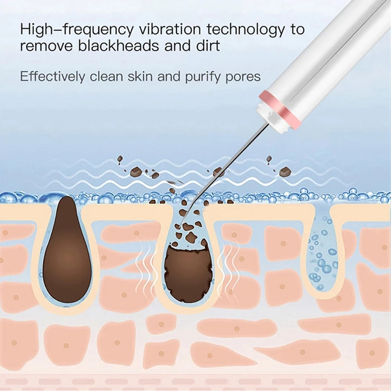 Ultrahangos Bőrradír Arc Spatula Lapát Ion Arc Mélytisztító Mitesszer eltávolító Pórustisztító Arc Lift Beauty Devices