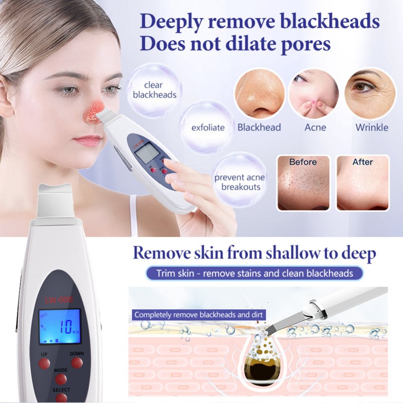 Kezdőlap Ultrahangos bőrradír mély arctisztító gép eltávolítása arc ultrahangos peeling lapát tiszta lifting spatula eszköz