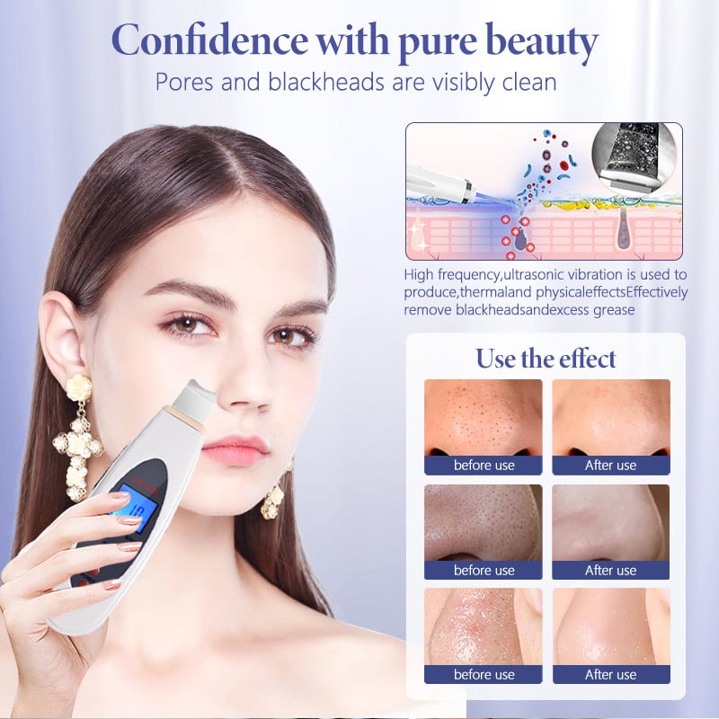 Kezdőlap Ultrahangos bőrradír mély arctisztító gép eltávolítása arc ultrahangos peeling lapát tiszta lifting spatula eszköz