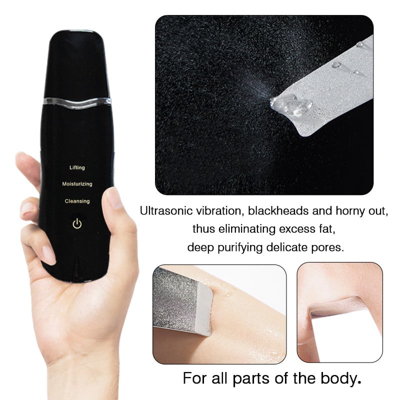 Ultrahangos bőrradír Arc mitesszer akne eltávolító készülék peeling lapát hámlasztó Clean Machine arc vibrációs masszírozó