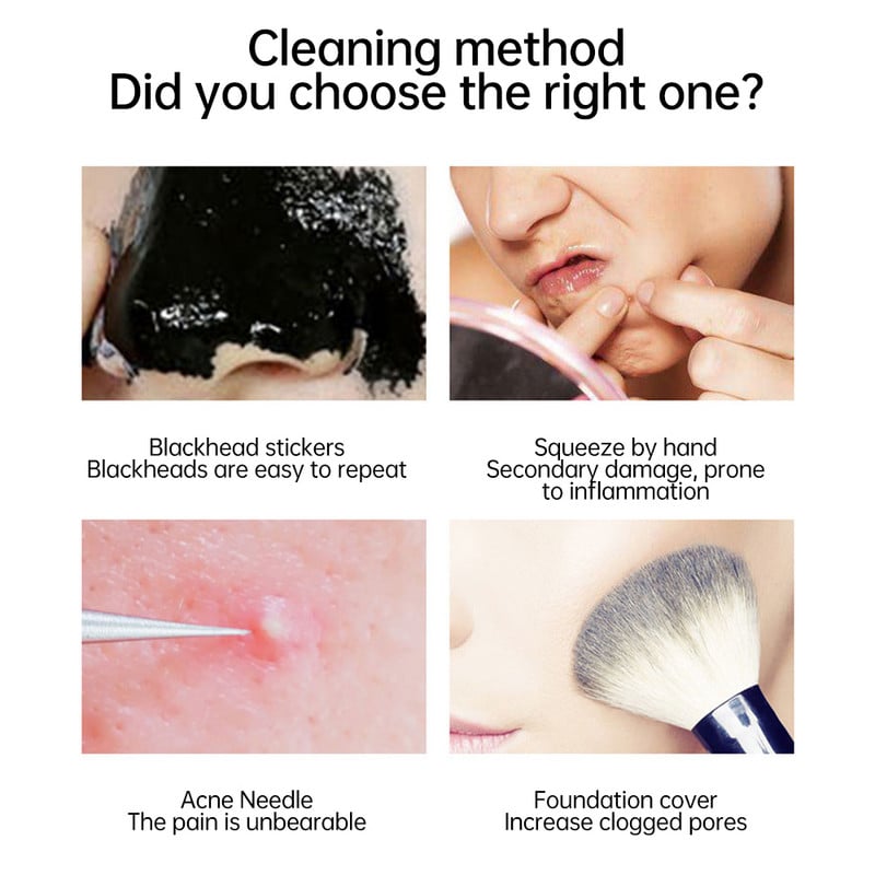 Elektromos arcvibrációs ultrahangos bőrradír EMS impulzus mikro peeling lapát mitesszer zsugorító pórus eltávolító bőr lifting