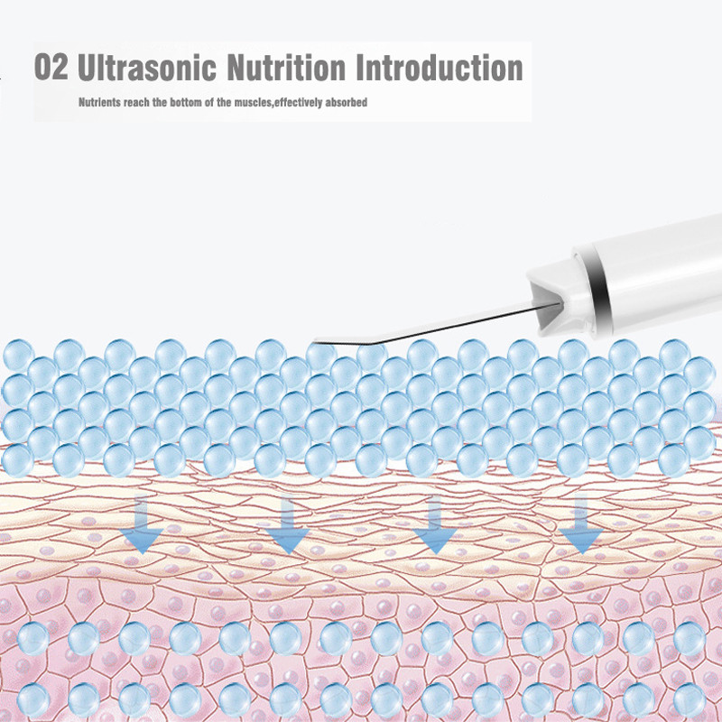 Ultrahangos bőrradír mély arctisztító gép mitesszer peeling lapát arc pórustisztító arcbőrradír lifting gép