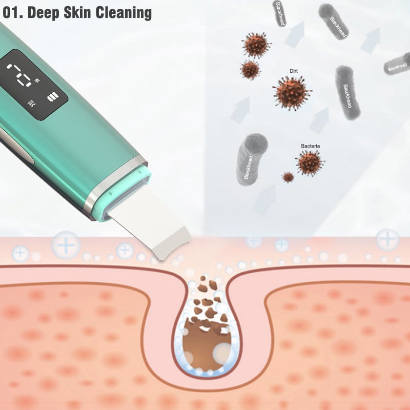 Ultrahangos arcbőrradír pórustisztító ion akne mitesszer eltávolító peeling lapátos tisztító EMS Face Lift masszírozó bőrápoló