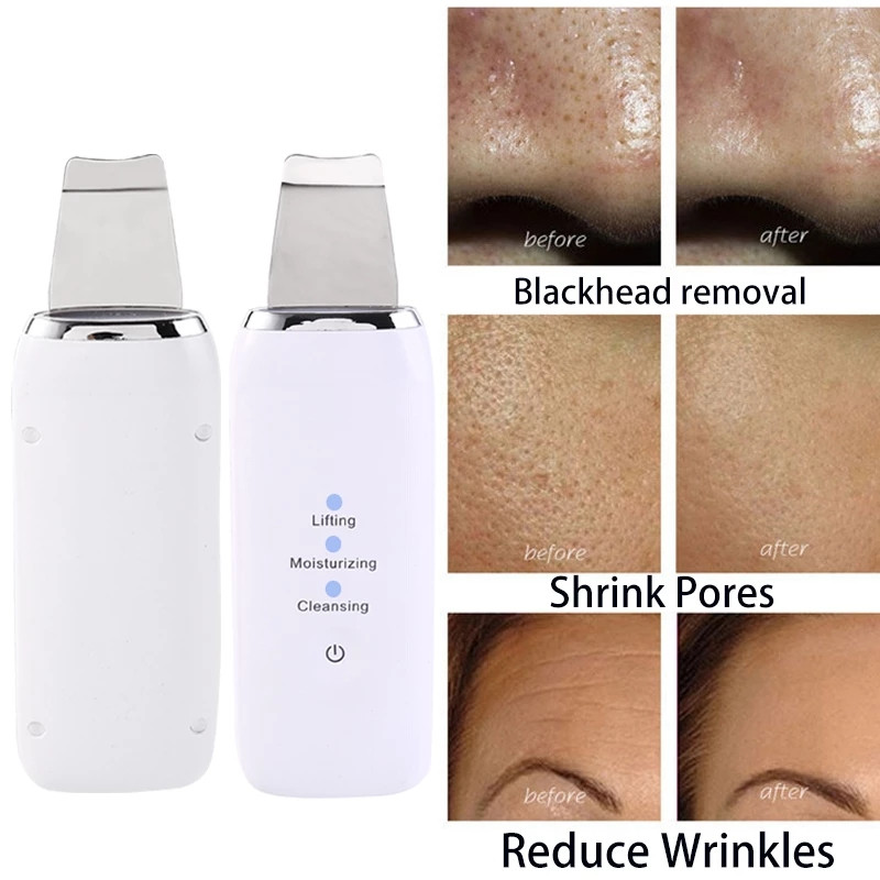 Bőrápolás Ultrahangos súroló Mélytisztító Arc Peeling Kavitációs Ultrahangos Spatula Bőrhámlasztó Szépségműszer
