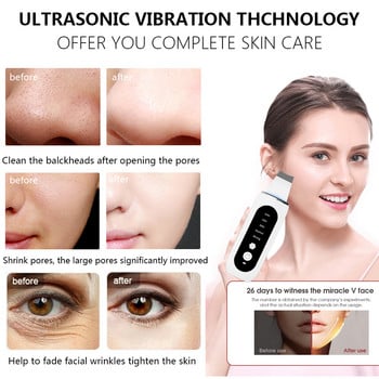 Ultrasonic Skin Scrubber Facial Shovel Deep Cleaning Remover Blackhead Face Cleanser Pore Dead Peeling Cavitation Ion EMS Lift