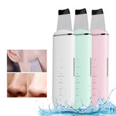 Ultrahangos bőrradír hámlasztó pórustisztító lapát Mitesszerek Mély arctisztító arcmasszázs Bőrápoló Szépségeszközök