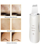 Bőrtisztító Ultrahangos bőrradír Beauty Instrument Device Black Dots Arcradír eltávolítása Ultrahangos ClVibráló Masszírozó