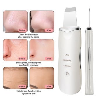 Skin Purifier Ultrasonic Skin Scrubber Beauty Instrument Device Remove Black Dots Face Scrubber Ultrasonic ClVibrating Massager