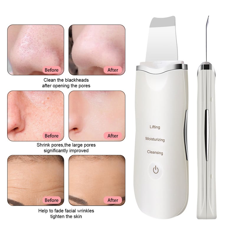 Bőrtisztító Ultrahangos bőrradír Beauty Instrument Device Black Dots Arcradír eltávolítása Ultrahangos ClVibráló Masszírozó