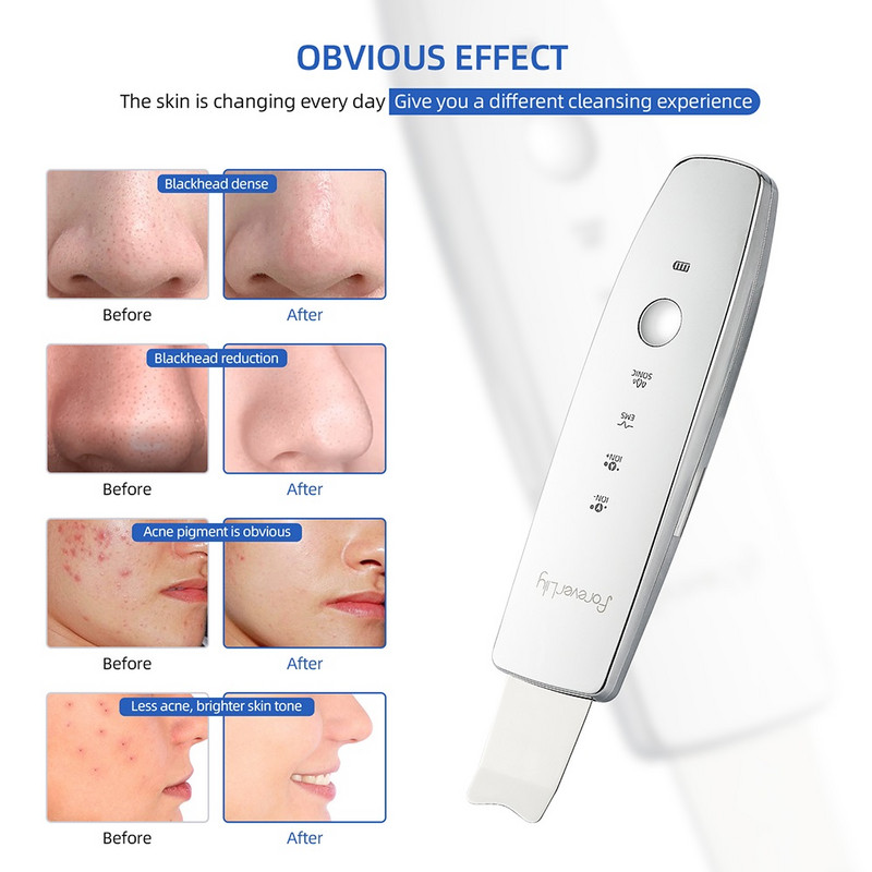 Ultrahangos bőrradír peeling lapát Ion akne mitesszer eltávolító mély arctisztító gép arc lifting arcmasszírozó