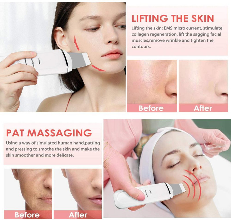 45°C Scrubber pentru piele facială, cu ultrasunete electric, cu ioni EMS, pentru îndepărtarea punctelor negre, masaj pentru lifting facial, pentru îndepărtarea ridurilor