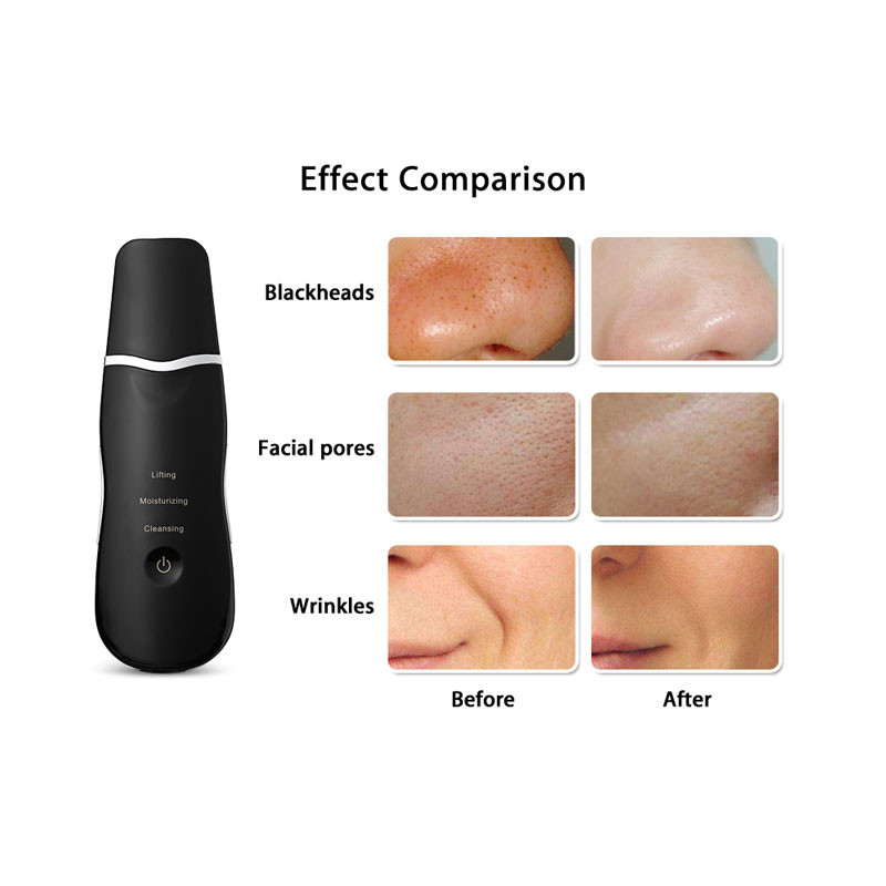 Ultrahangos bőrradír mély arctisztító gép peeling lapát arc pórustisztító arcbőrradír lifting gép