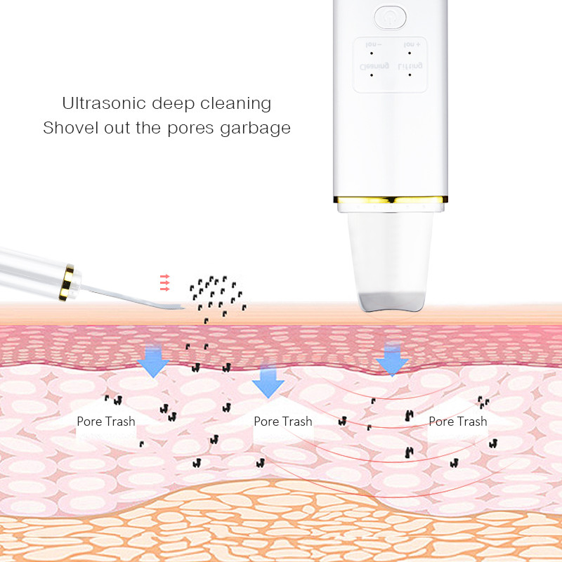Bőrradír dobozos mély arctisztító lapátos spatula nem ultrahangos arcradír Peeling mitesszer eltávolító lift masszírozó