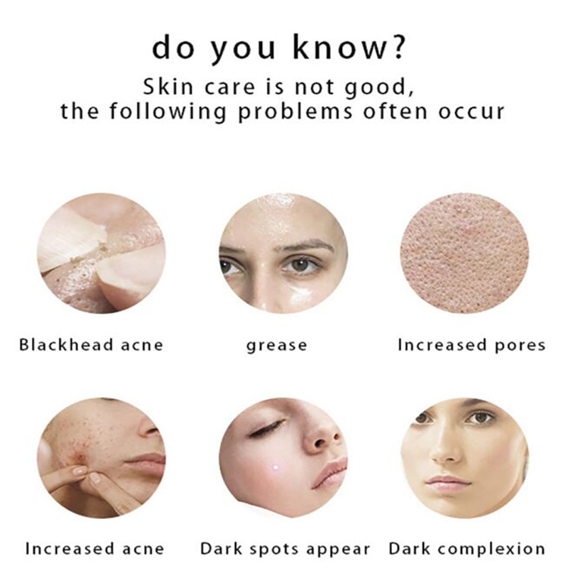 Ultrahangos bőrradír vibrációs arc spatula mitesszer eltávolító arcradír lapát Tiszta kavitációs peeling arc lifting