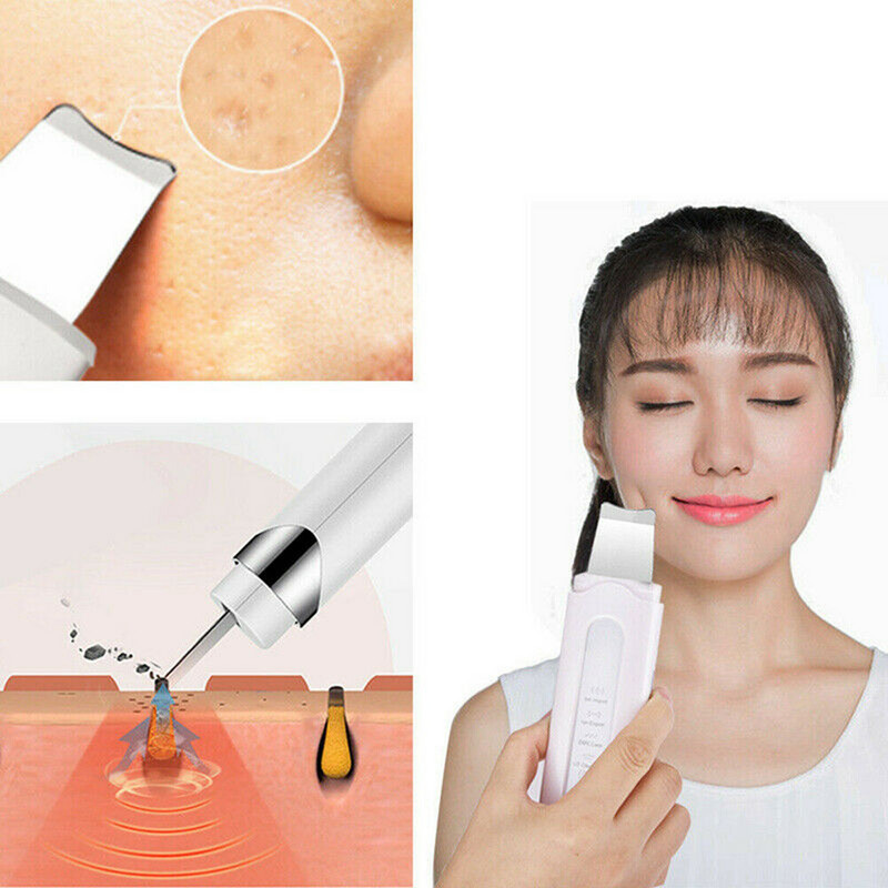 Ultrahangos bőrradír eltávolító arc spatula elektromos pórusok mélytisztító akne mitesszer eltávolító peeling lapát készülék szépséggép