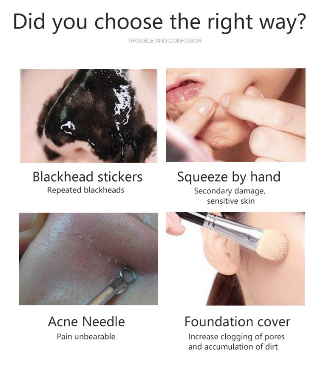 Ultrahangos arctisztító mitesszer eltávolító akne pórusos arctisztító EMS Face Lift peeling lapát Ion ultrahangos bőrradír