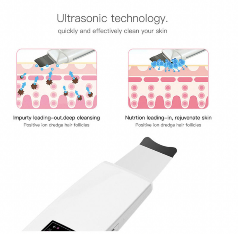 Ultrahangos bőrradír mély arctisztító akne mitesszer eltávolítása arc lifting ultrahangos peeling tiszta bőrápoló eszköz