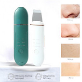 Arcbőrradír ultrahangos vibrációs mitesszer eltávolító EMS Facial Lifting arctisztító bőrápoló eszközök szépségápolási eszközök