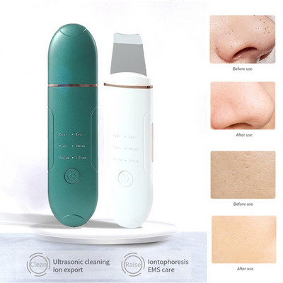 Arcbőrradír ultrahangos vibrációs mitesszer eltávolító EMS Facial Lifting arctisztító bőrápoló eszközök szépségápolási eszközök