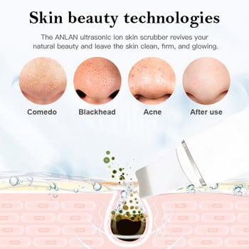 Ultrasonic Skin Scrubber Facial Pore Cleaner Remover Blackhead Ion Shovel Deep Face Cleaning Συσκευή Sonic Peeling Εργαλείο περιποίησης δέρματος