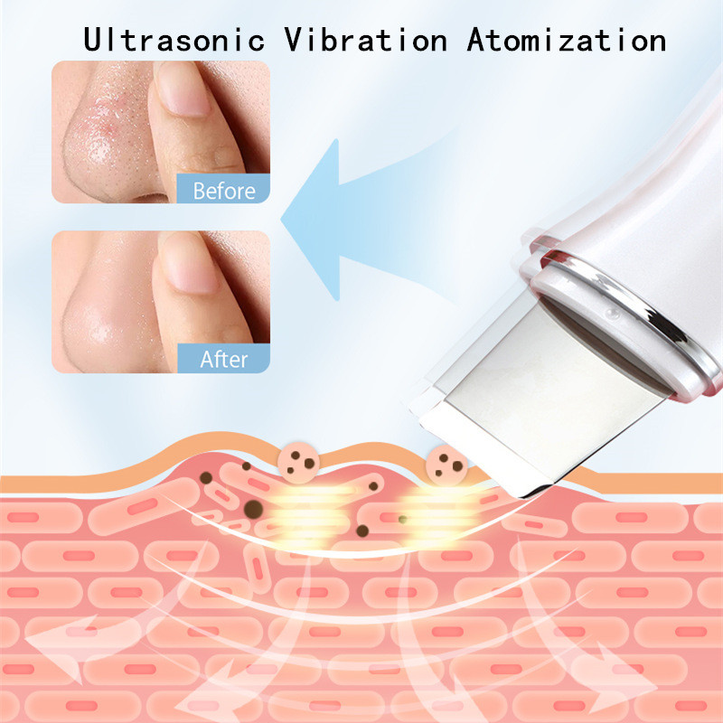 Elektromos ultrahangos arctisztító súroló arcbőrradírozó peeling mitesszer eltávolító mikroáramú ránctalanító készülék