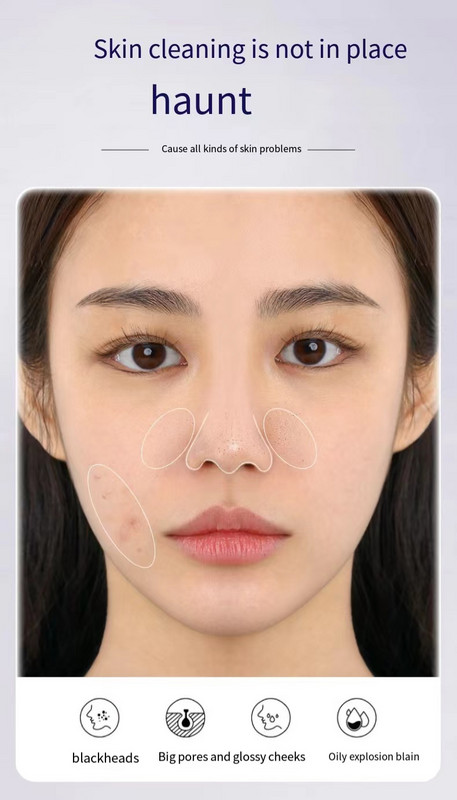 Ultrahangos bőrradír peeling lapát EMS mikroáramú ion akne mitesszer eltávolító arc mélytisztító arc lifting eszközök