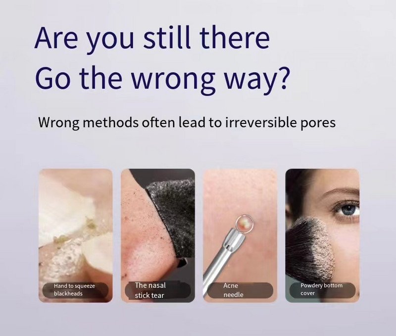Ultrahangos bőrradír peeling lapát EMS mikroáramú ion akne mitesszer eltávolító arc mélytisztító arc lifting eszközök