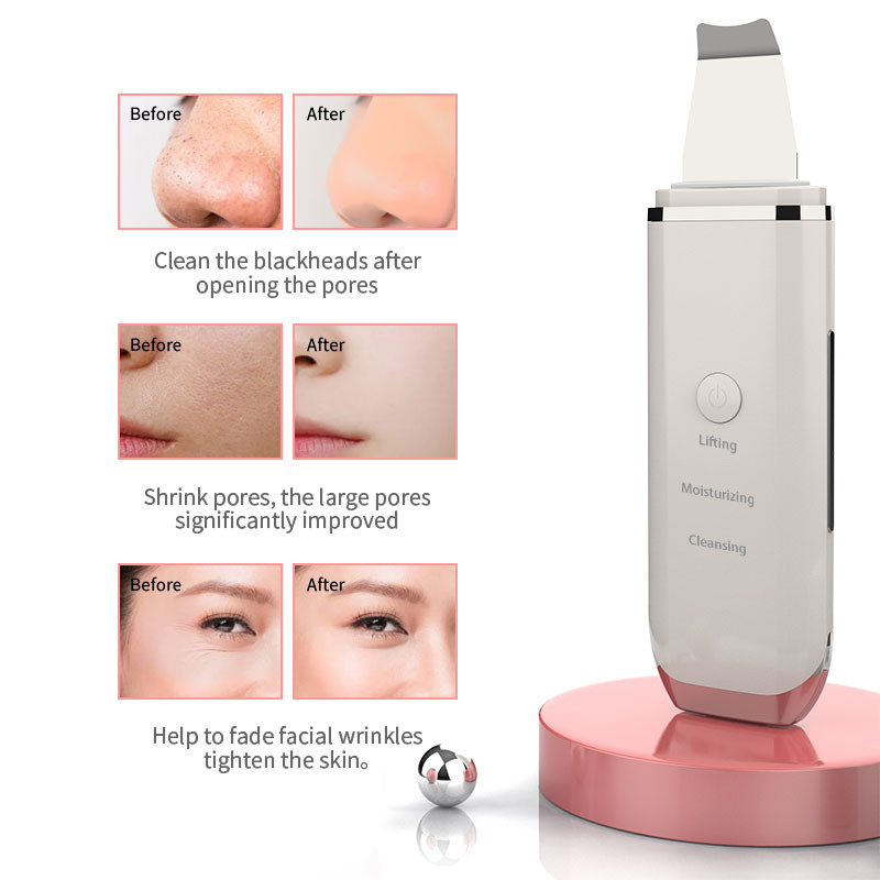 Ultrasonic Skin Scrubber Pore Cleaner Face Ion Cleaning Συσκευή απολέπισης Ανύψωση προσώπου κραδασμών Μηχάνημα φτυαριών αφαίρεσης μαύρων στιγμάτων