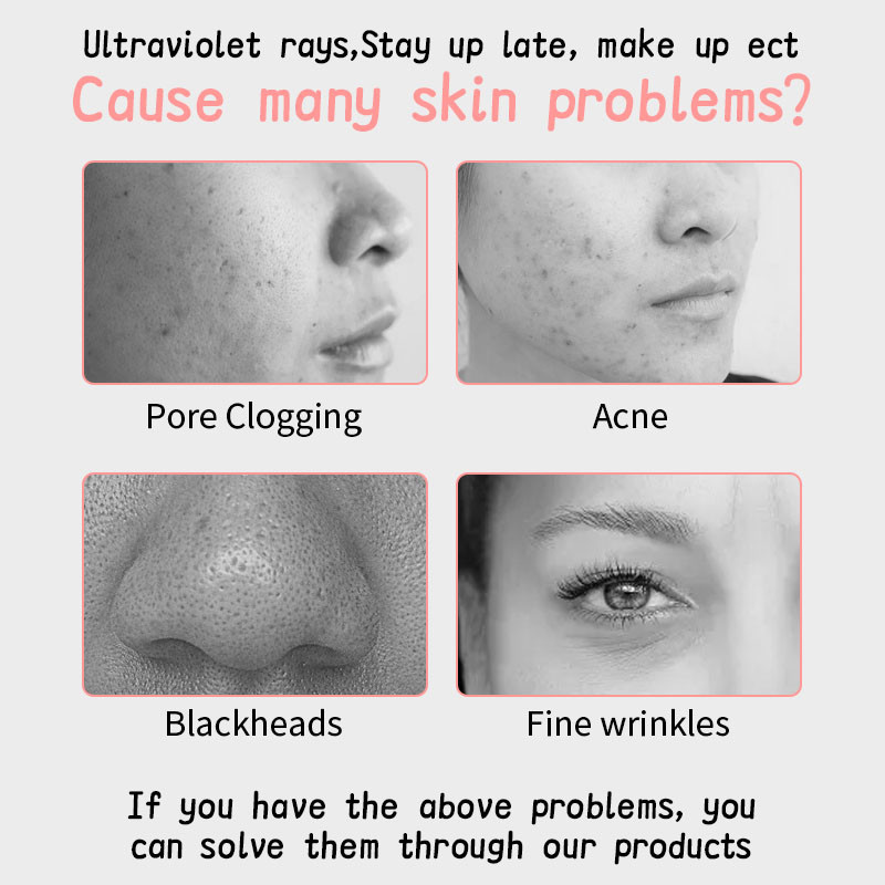 Ultrasonic Skin Scrubber Pore Cleaner Face Ion Cleaning Συσκευή απολέπισης Ανύψωση προσώπου κραδασμών Μηχάνημα φτυαριών αφαίρεσης μαύρων στιγμάτων