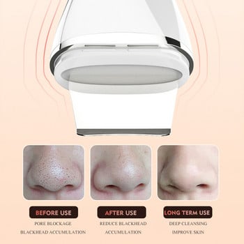 Ultrasonic Cleaner Face Scrubber Led EMS Lon Massager For Face Peeling Lifting Skin Care Σπάτουλα προσώπου