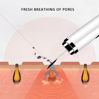 Ултразвуков скрубер за кожата на лицето Дълбоко почистване Средство за премахване на черни точки Пилинг на мъртва кожа Лопата Почистване на порите Продукт за грижа за кожата