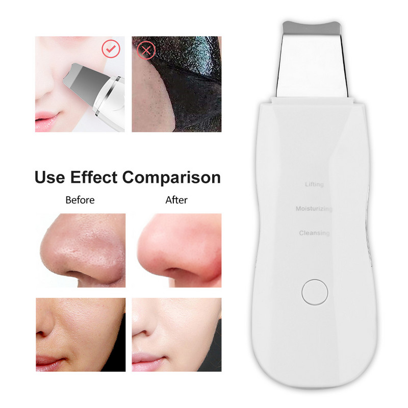 USB Recharge Skin Scrubber Vibrációs Arc Spatula Mitesszer eltávolító Arcradír Lapát Clean Kavitációs Peeling Arckezelés
