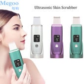 Újratölthető ultrahangos bőrradír arc mélytisztító peeling lapát bőrlapát eltávolítja a szennyeződést mitesszer csökkenti a ráncokat