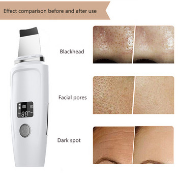 Υπερηχητικό Skin Scrubber Spatula EMS Face Lifting Acne Remover Blackhead Ηλεκτρικό εργαλείο μασάζ δέρματος