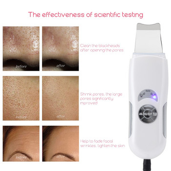 Ultrasonic Skin Scrubber Deep Face Cleaning Machine Peeling Shovel Facial Pore Cleaner Face Skin Scrubber Lift Machine