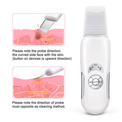 Ultrahangos bőrradír mély arctisztító gép peeling lapát arc pórustisztító arcbőrradír lifting gép