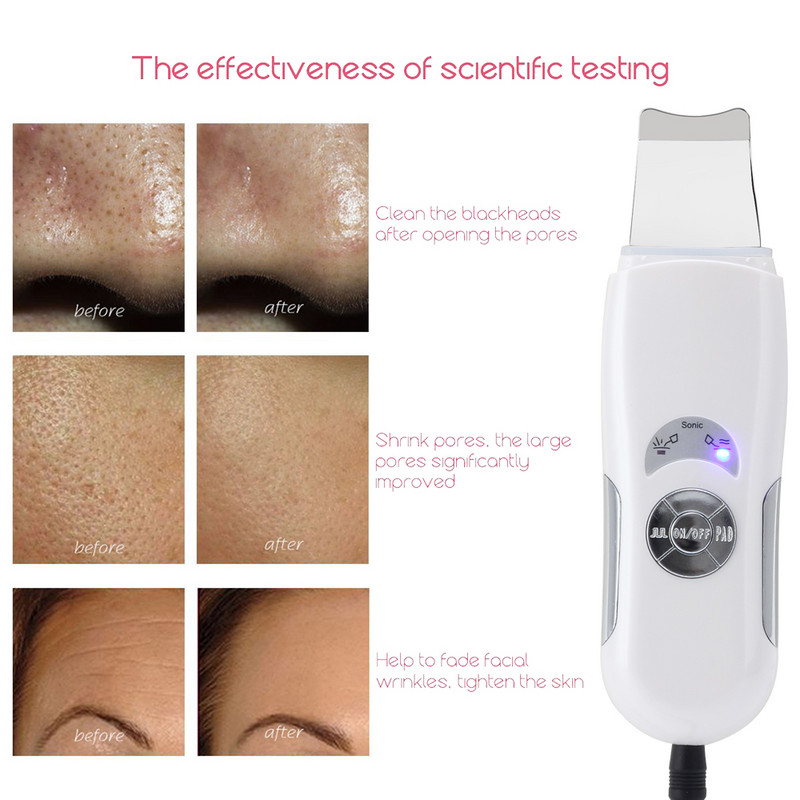 Ultrahangos bőrradír mély arctisztító gép peeling lapát arc pórustisztító arcbőrradír lifting gép