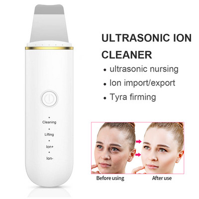 Facial Cleaner Dermabrasion Ion Ultrasonic Skin Scrubber and Ultra Sonic Beauty Personal Care Εξοπλισμός Ακμής Pore Beauty